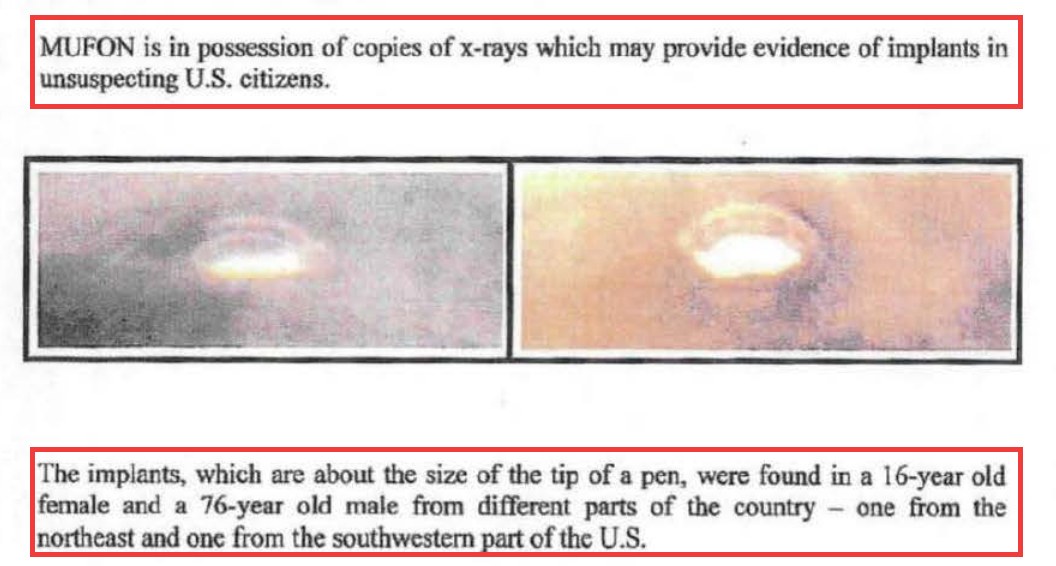 Part of page 3 of 5 of the Human Interface paper in DOW-UAP-D166: the sentence saying MUFON is in possession of copies of x-rays which may provide evidence of implants, two uncaptioned framed images, and the sentence that the implants, about the size of the tip of a pen, were found in a 16-year-old female and a 76-year-old male. Red outlines mark the two sentences.